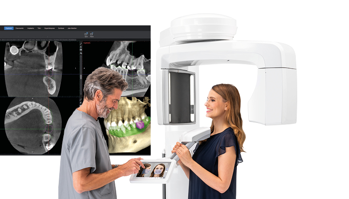 Una nuova tecnologia per la radiografia panoramica, la TAC CONE BEAM al servizio della diagnostica maxillo-facciale.