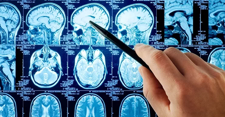Neurologia